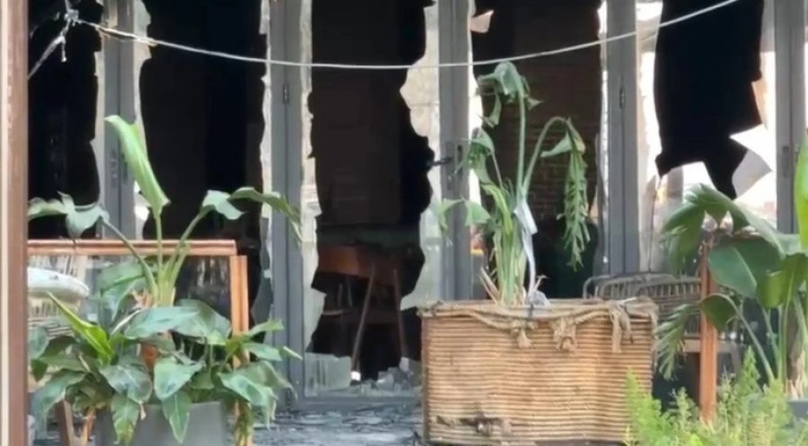 Zjarri në hotelin në Vlorë, 25-vjeçarja që pësoi 85% djegie të trupit dërgohet për trajtim në Turqi