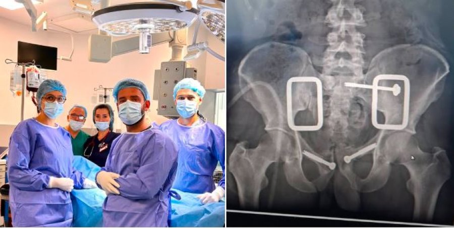 QKUK ja realizon me sukses ndërhyrje të avancuar për frakturë komplekse të pelvikut