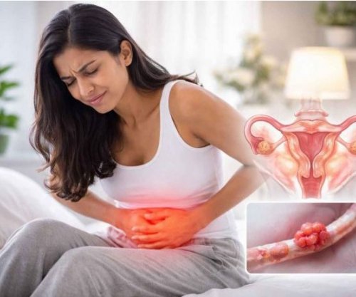 A është melatonina çelësi për të frenuar endometriozën?
