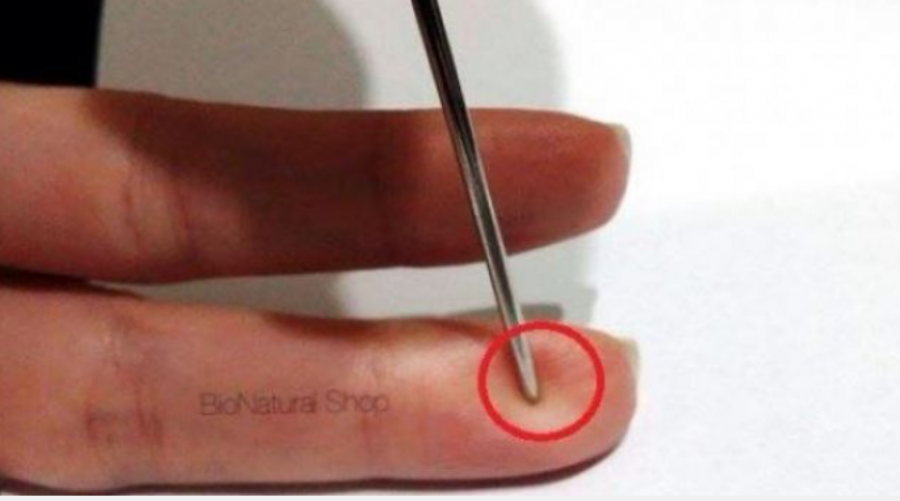 parainfarkti-ja-si-t-i-shpetoni-jeten-dikujt