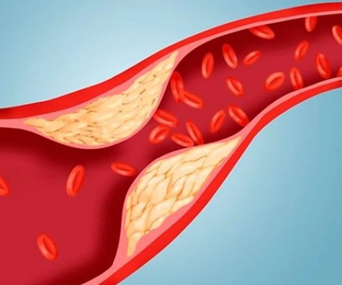 Ushqimet që ndikojnë pozitivisht kundër yndyrave në gjak