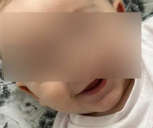 Arti Haliti 7-muajsh ka nevojë për ndihmë, i duhen 30 mijë euro për shërim në Austri