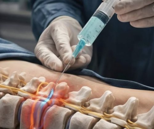 Zvicra krijon xhelin injektues që riparon shtyllën kurrizore pa kirurgji