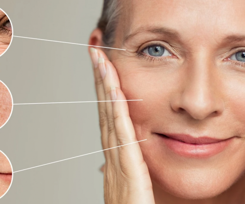 A do të thotë që lëkura me yndyrë do të më sjellë më pak rrudha?