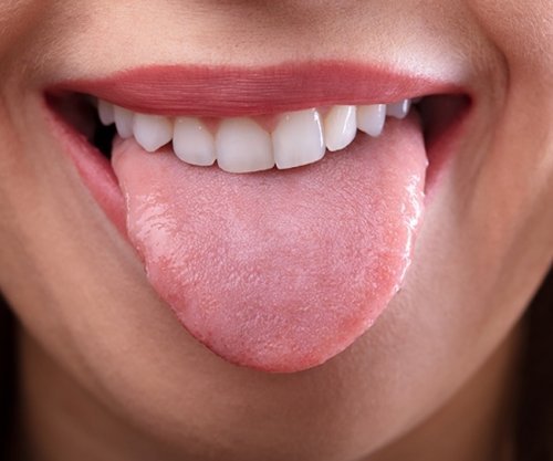 Si ta zgjidhni problemin e tharjes së gojës?