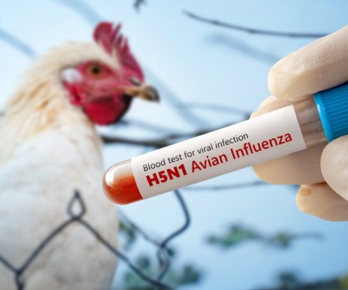 AUV-i ndalon importin e shpezëve dhe produkteve të tyre nga disa regjione të Polonisë