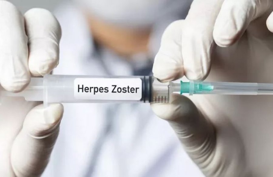 Vaksina kundër herpesit ngadalëson plakjen