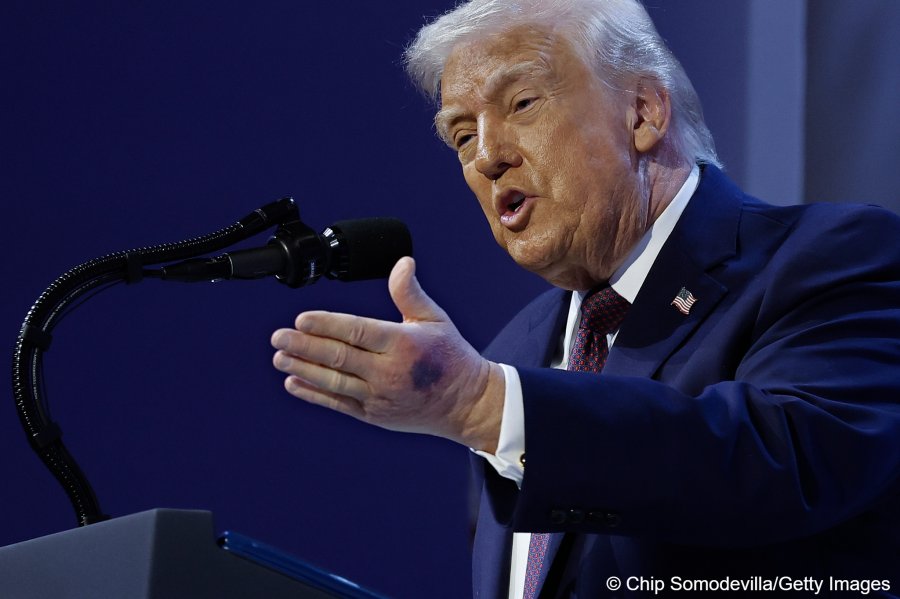 Dora e mavijosur e Trumpit ndez spekulime për shëndetin e presidentit amerikan