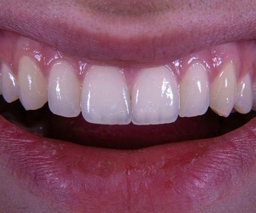 Jo zemra, jo truri; dhëmbët zbulojnë sekretin e jetëgjatësisë