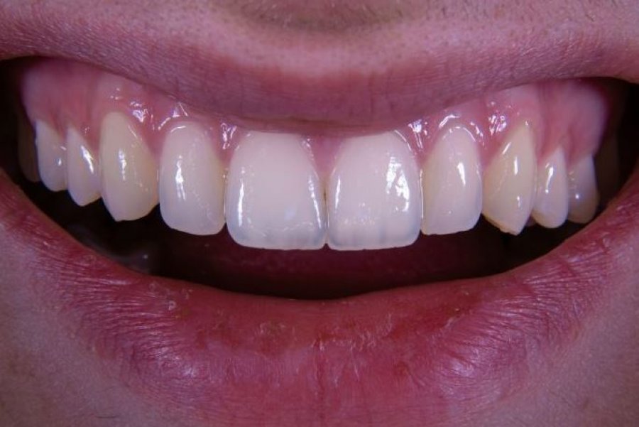 jo-zemra-jo-truri-dhembet-zbulojne-sekretin-e-jetegjatesise