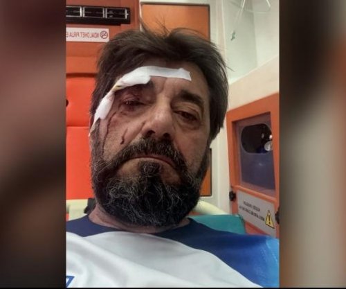 Sulmohet brutalisht në Tiranë, analisti Ilir Demaliaj