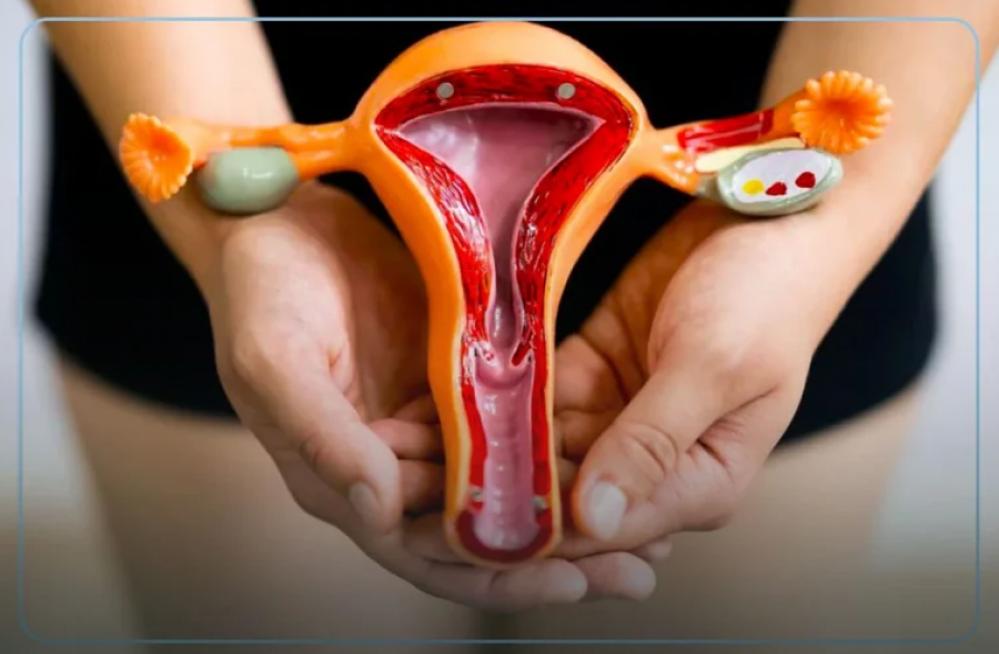 migrena-problemet-me-tretjen-ankthi-dhe-depresioni-mund-te-jene-shenja-te-endometriozes