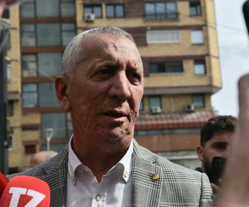 Quni: Do të pajtohem me vendimin që merret në mbledhje