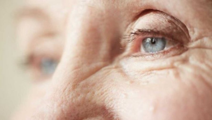 pse-dobesohet-shikimi-me-kalimin-e-moshes