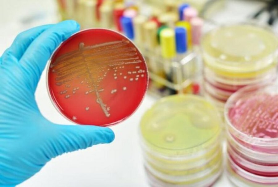bakteret-ushqimore-si-salmonella-dhe-kampilobakteri-po-behen-rezistente-ndaj-antibiotikeve-ne-evrope