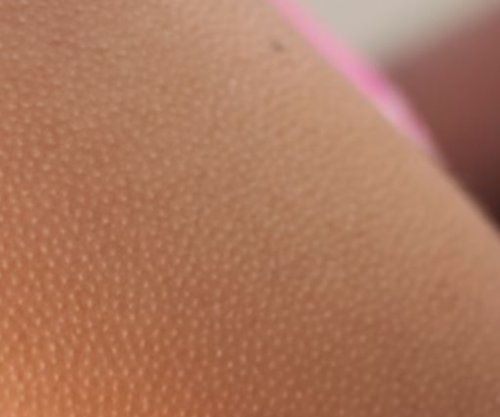 Ethet në trup, ja çfarë tregojnë për shëndetin