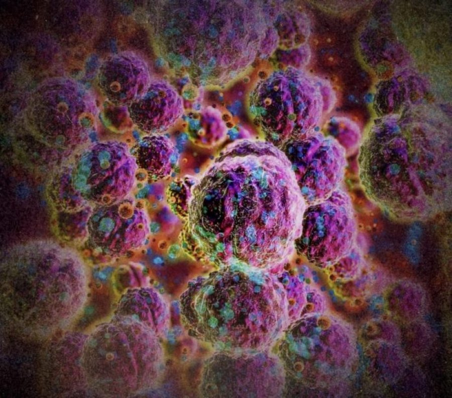 Meningjiti  Simptomat dhe mënyrat e përhapjes