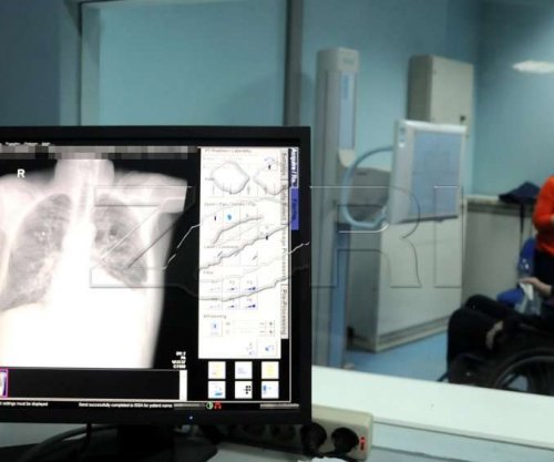 Rreth 500 raste të reja me kancer në QKUK ende pa u mbyllur tremujori