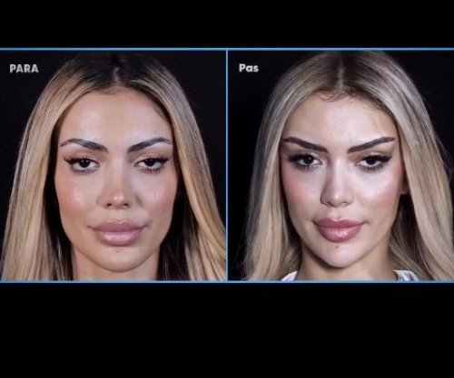 Publikohen pamjet e ndërhyrjeve të Brikenës para BBVA, reagime të shumta në rrjet