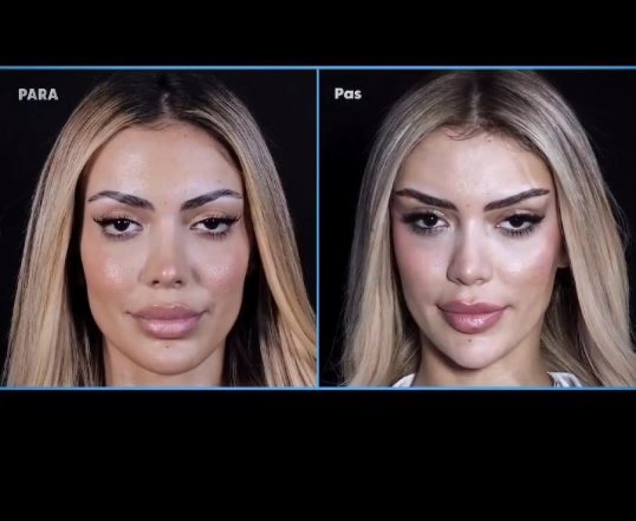 Publikohen pamjet e ndërhyrjeve të Brikenës para BBVA, reagime të shumta në rrjet