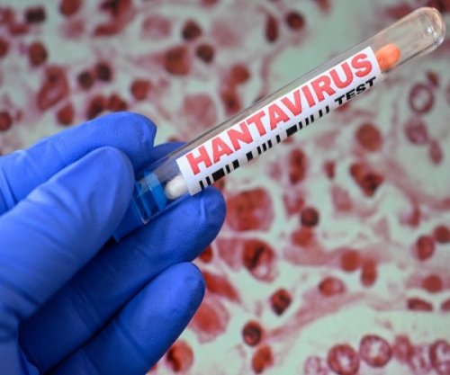 Simaku: Asnjë rast me hantavirus në Shqipëri, rreziku i ulët