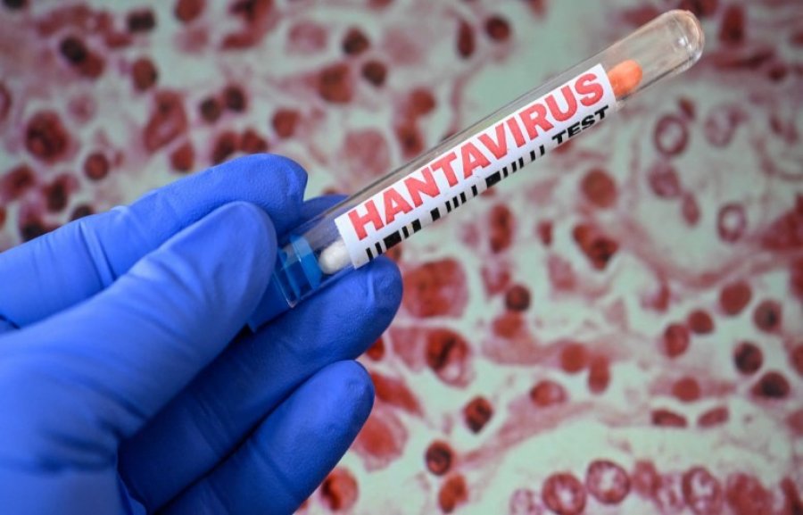 Simaku  Asnjë rast me hantavirus në Shqipëri  rreziku i ulët