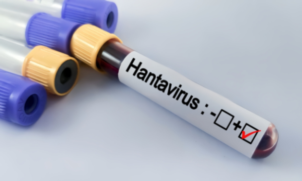 Spanja konfirmon një rast të ri me hantavirus