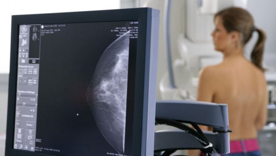 Revolucion në onkologji  Kimioterapia mund të shmanget në dy të tretat e rasteve