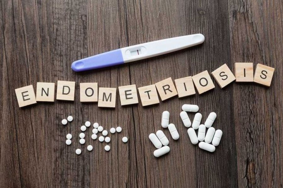 Një ilaç kundër parazitëve mund të hapë rrugë të reja për trajtimin e endometriozës
