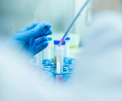OBSH: Rasti i parë te njerëzit me virusin Samonda, një person humb jetën në Francë