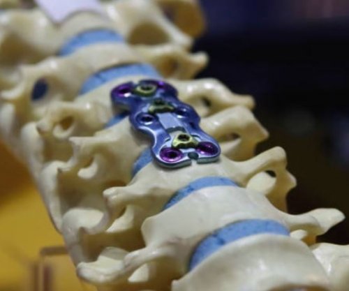 Shkencëtarët zbulojnë se implantet dentare mund të ndikojnë në reagimin imunitar ndaj infeksioneve