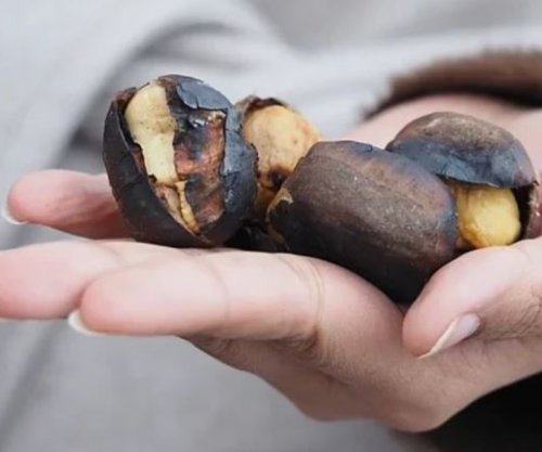Gështenja mund të ndihmojë zemrën, tretjen dhe humbjen e peshës