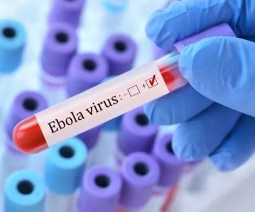 Mbi 7000 raste të konfirmuara me Ebola në Kongo