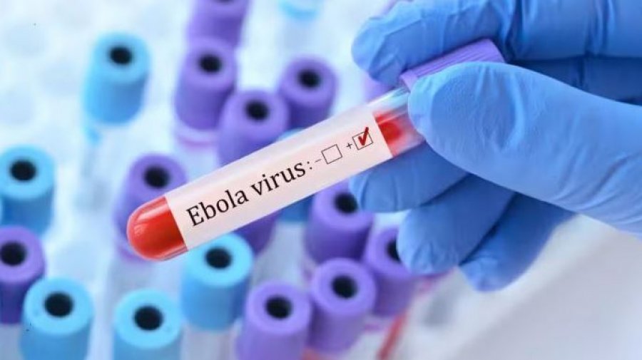 Mbi 7000 raste të konfirmuara me Ebola në Kongo